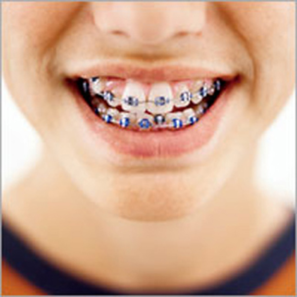 Orthodontics