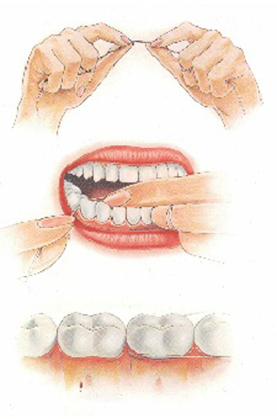 Flossing